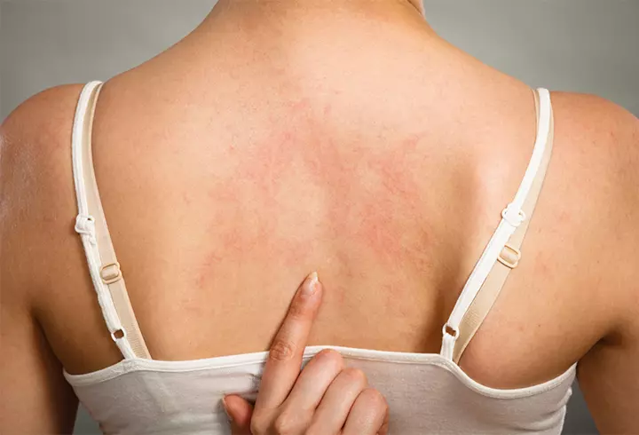 Organizaţia Mondială a Sănătăţii NU crede în apariția celui de-al doilea val COVID-19: "Virusul va avea dificultăţi să supravieţuiască". Îndemnul OMS către populație