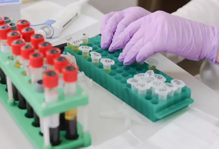 Organizaţia Mondială a Sănătăţii NU crede în apariția celui de-al doilea val COVID-19: "Virusul va avea dificultăţi să supravieţuiască". Îndemnul OMS către populație