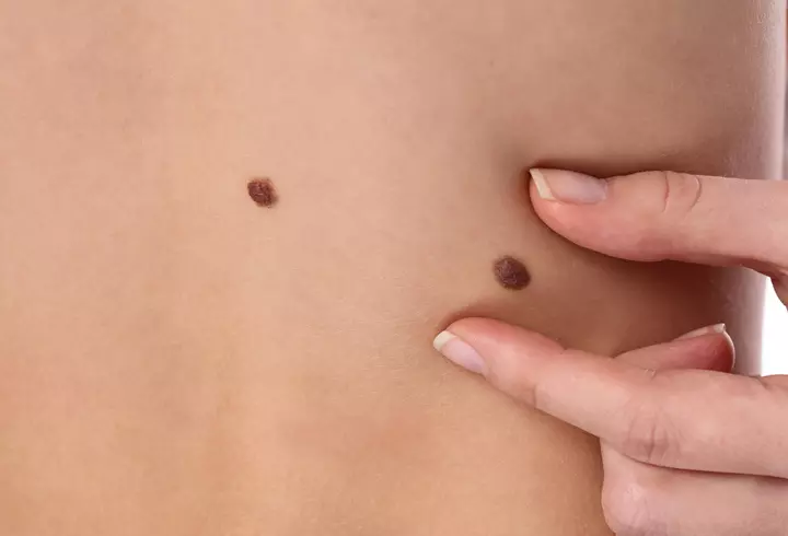 Mască de față cu aloe vera. Rețeta și beneficii