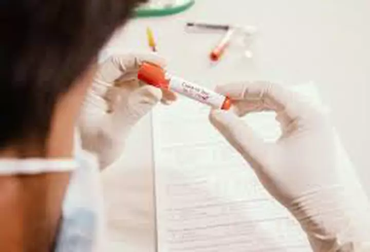 Încă un medic din România a murit de COVID-19. Profesorul Istvan Benedek a fost primul medic român care a efectuat un transplant de măduvă la un adult