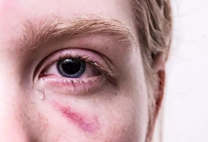 Ce tratamente anti COVID-19 se folosesc în România, atât pentru pacienții cu forme ușoare, cât și pentru cei în stare gravă: "Toate au efecte secundare"