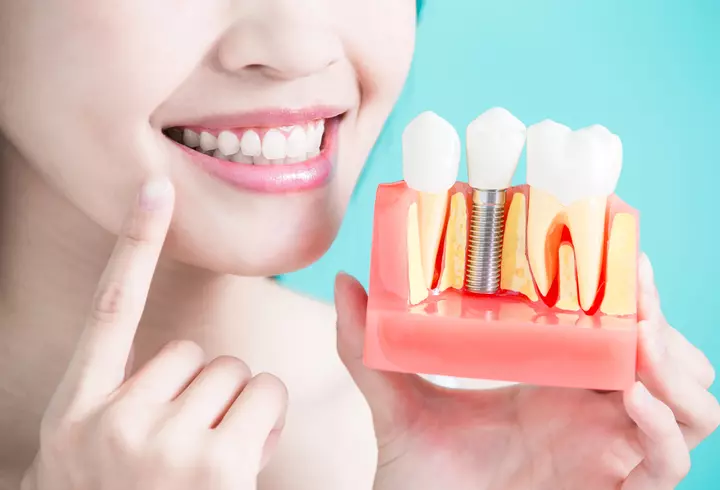 (P) Funcții și accesorii potrivite pentru o vitrină frigorifică