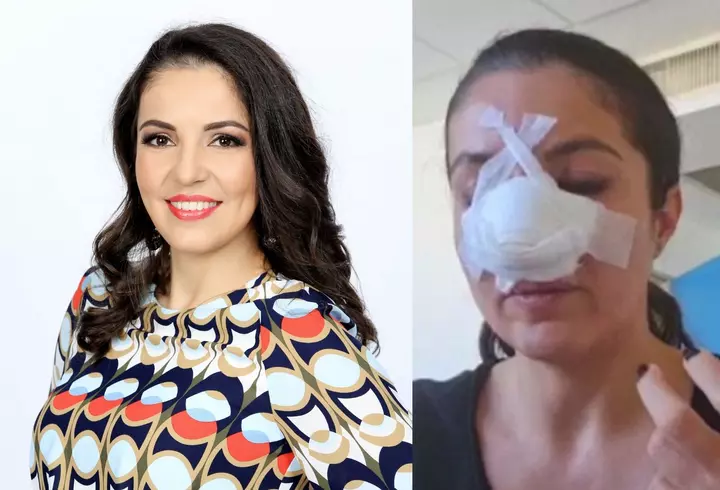 Ce diagnostic a primit Liviu Vârciu. Artistul urmează un tratament special: "Am stat la pat în ultimele zile"