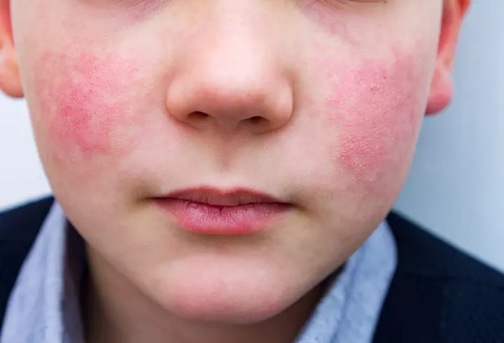 Dietă de detoxifiere după sărbători. Cum să slăbești repede