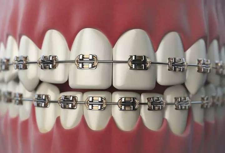 Cum accesorizăm rochiile cu imprimeu floral