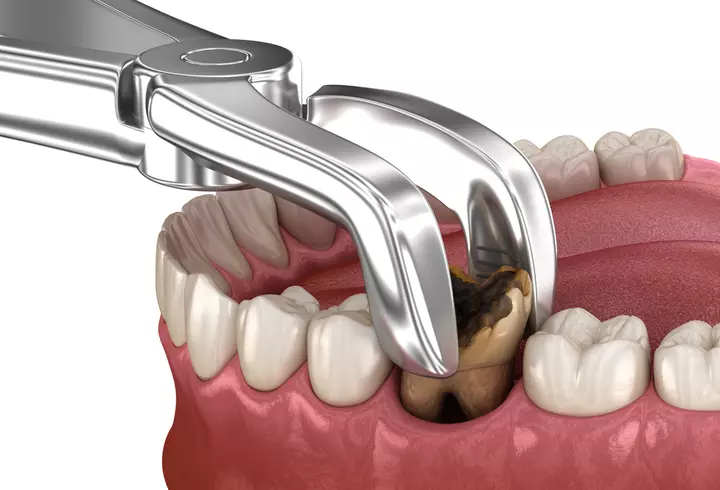 Cum să încetinești procesul de îmbătrânire a pielii: 3 sfaturi utile