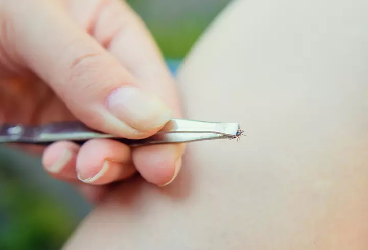 Ce să mănânci când ești constipat 