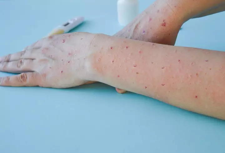 Fructul banal care poate afecta ficatul. Mihaela Bilic avertizează