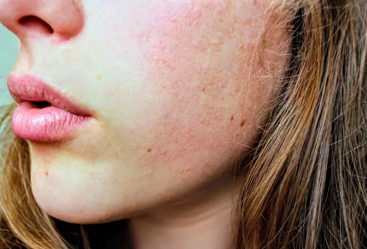 TROPIC EXOTIC – Limited edition. Aspect de vară – cu noua ediție limitată Tropic Exotic