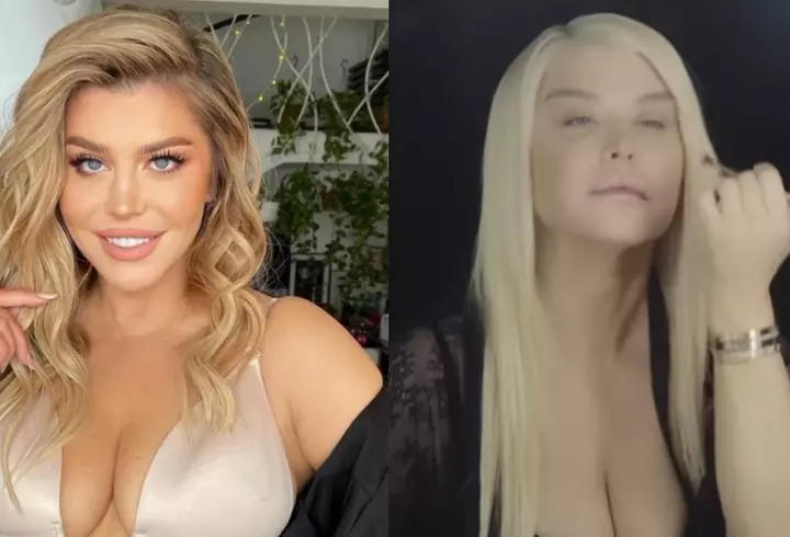 De ce are Iulia Albu fața umflată: "Am această problemă cu..."