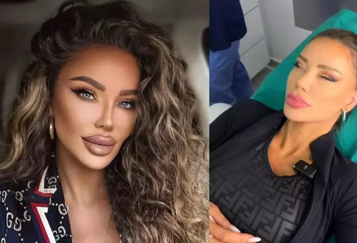 Bianca Drăgușanu, cu sânii la vedere într-o bluză transparentă și mulată. Vedeta a dezvăluit ultimele operații estetice pe care și le-a făcut