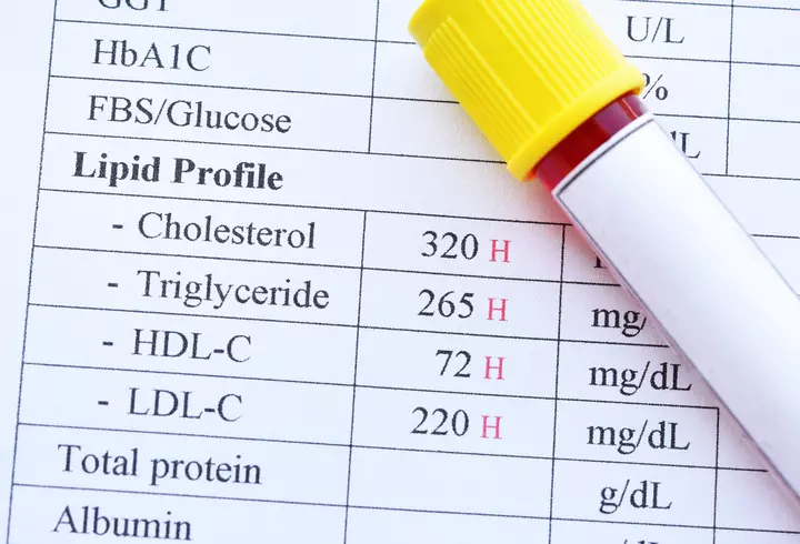 Ce înseamnă regula 10 la 1 în nutriţie