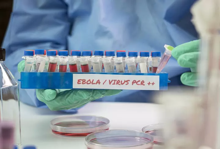 De ce nu poţi să strănuţi fără să închizi ochii