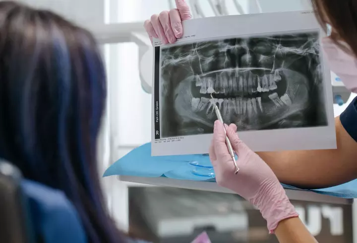 Cum pot tehnologiile disponibile la Mb Dental să reducă timpul petrecut la dentist