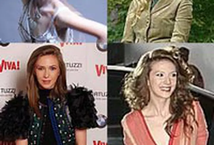 Akne-Syt in tratamentul acneei usoare, moderate si severe