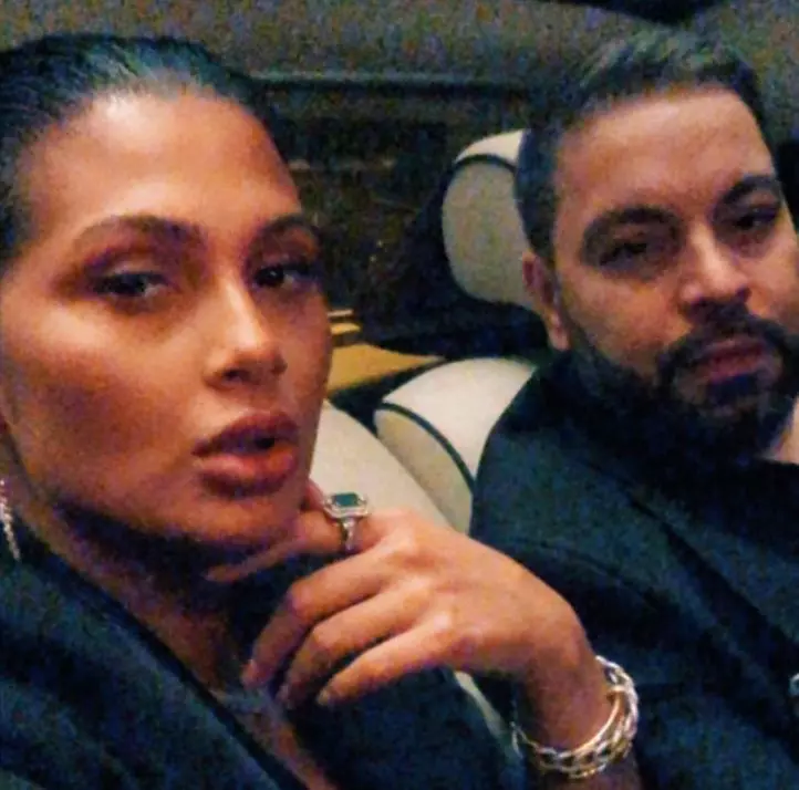 roxana-dobre-interventie-estetica-2