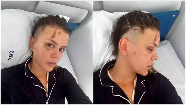 emily-burghelea-inainte-de-prima-operatie