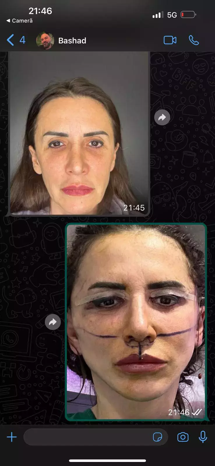 mara-banica-lifting-facial