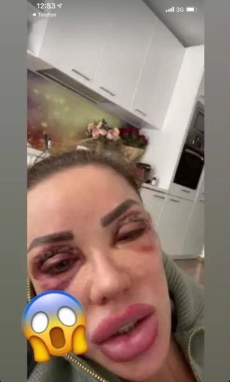 Bianca Drăgușanu, bătută (2)