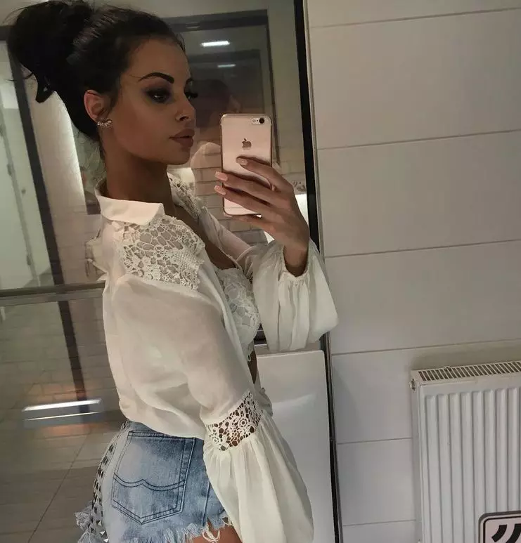 Justyna-operatii-estetice-4