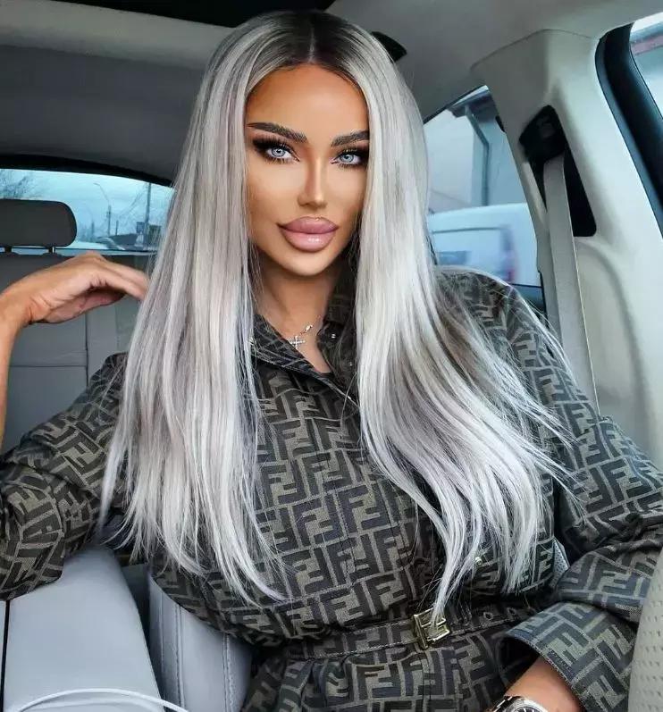 bianca-dragusanu-operatii-estetice-1