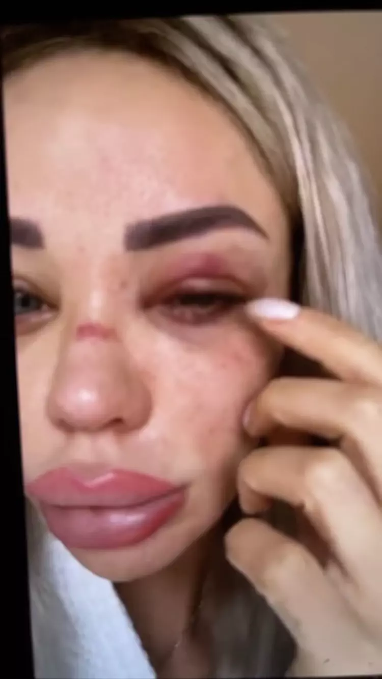 Bianca Drăgușanu bătută (7)1