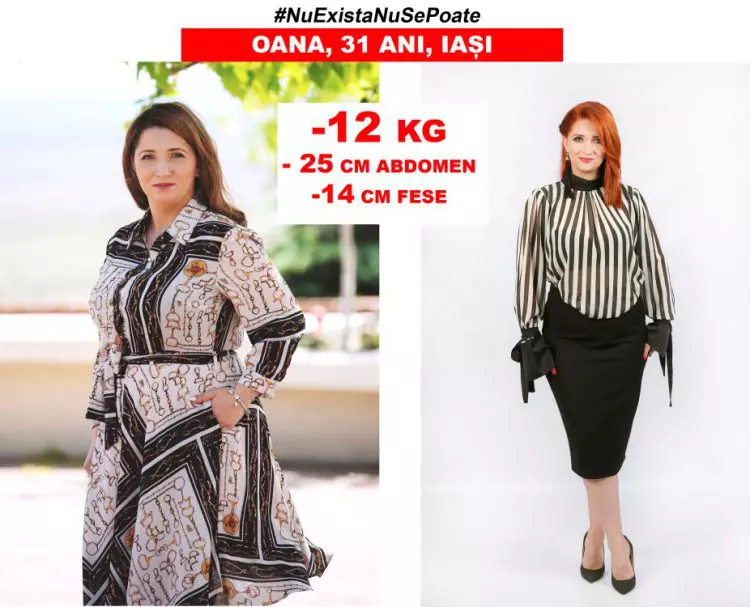 OANA