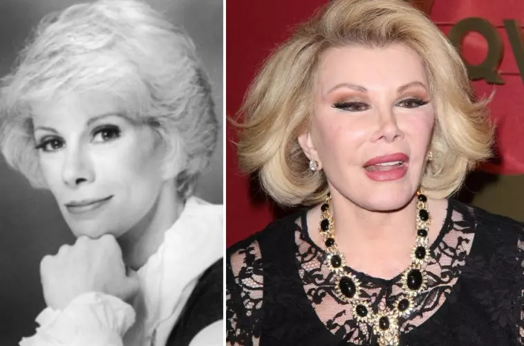 Joan_Rivers_01.jpg