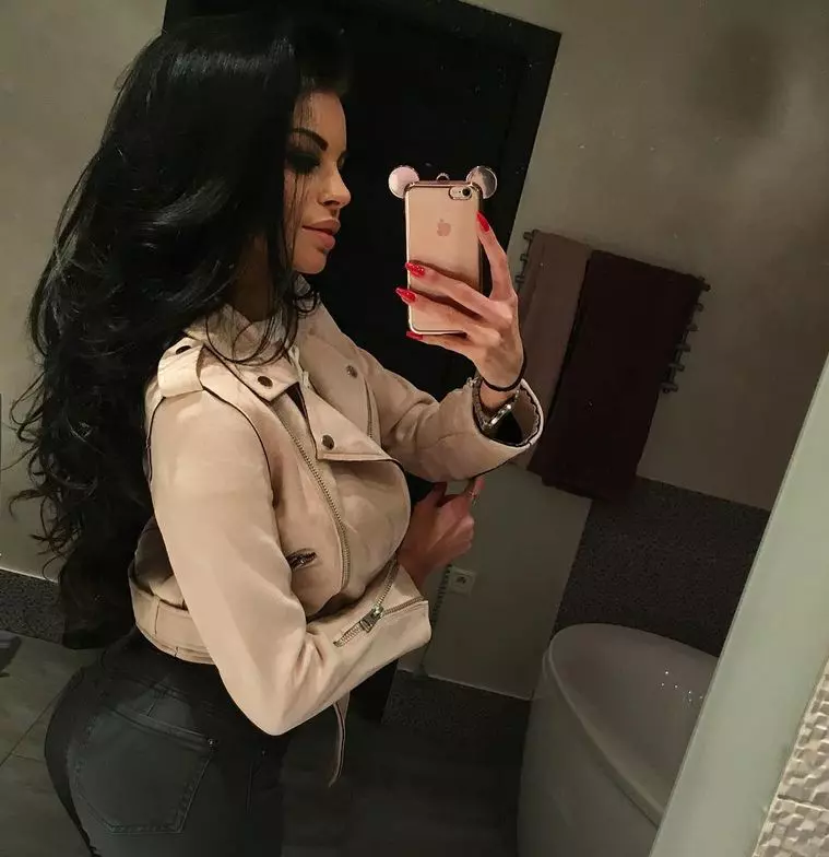 Justyna-operatii-estetice-7