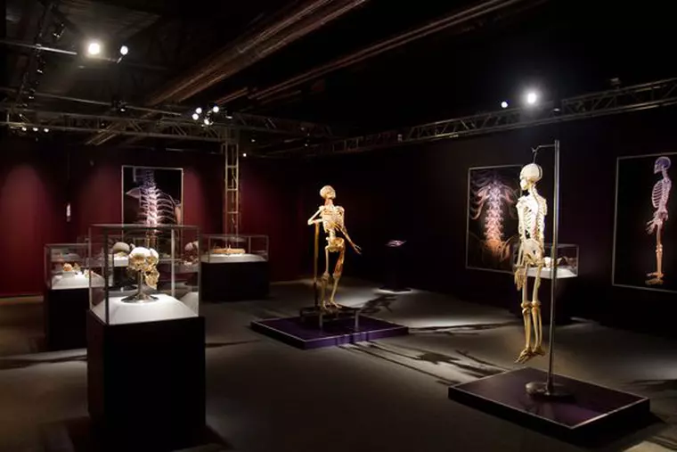 5. Gallery_Skeletal_ImageB