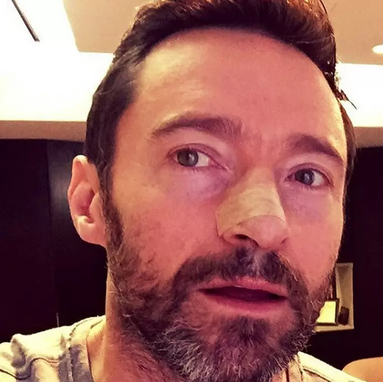 hugh jackman