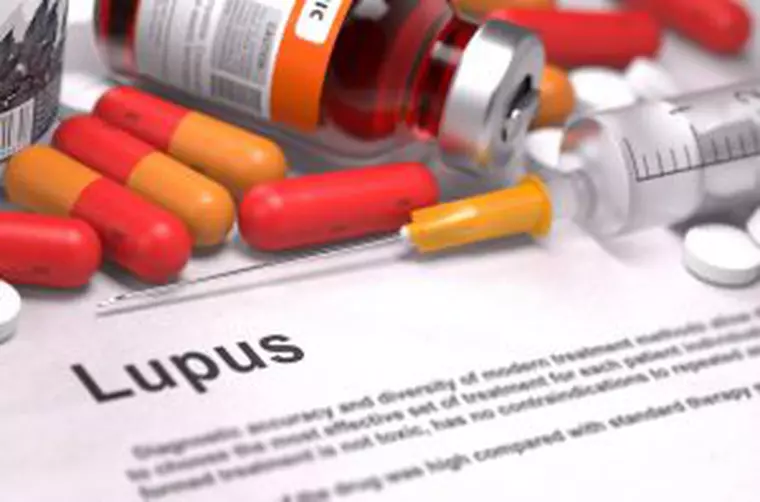 Boala Lupus diagnosticarea bolii lupus. Medicamente pentru boala lupus