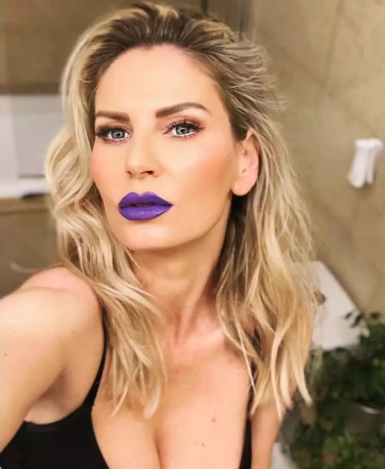 Andreea Banica fara alunita