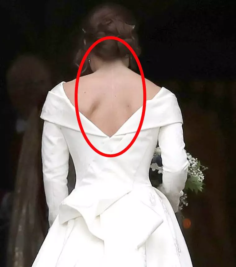 cicatricea printesei Eugenie in ziua nuntii