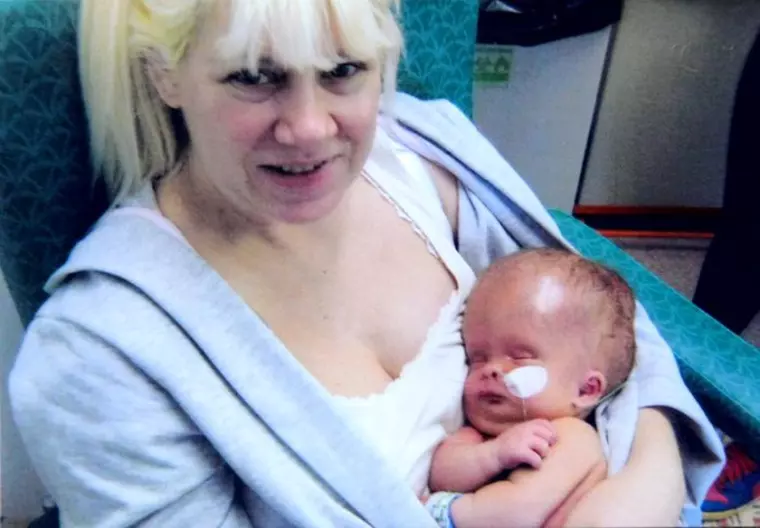 Băiețelul născut fără creier a împlinit șase ani. Cum a reușit să supraviețuiască