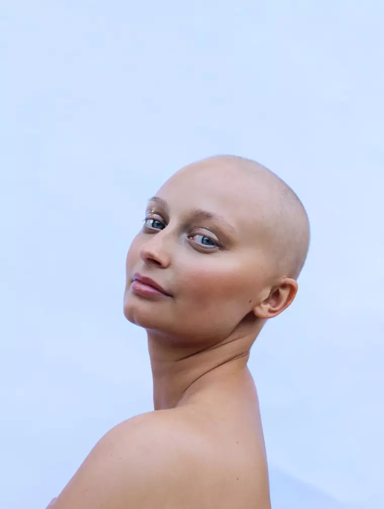 Olivia Smith, bolnava de cancer