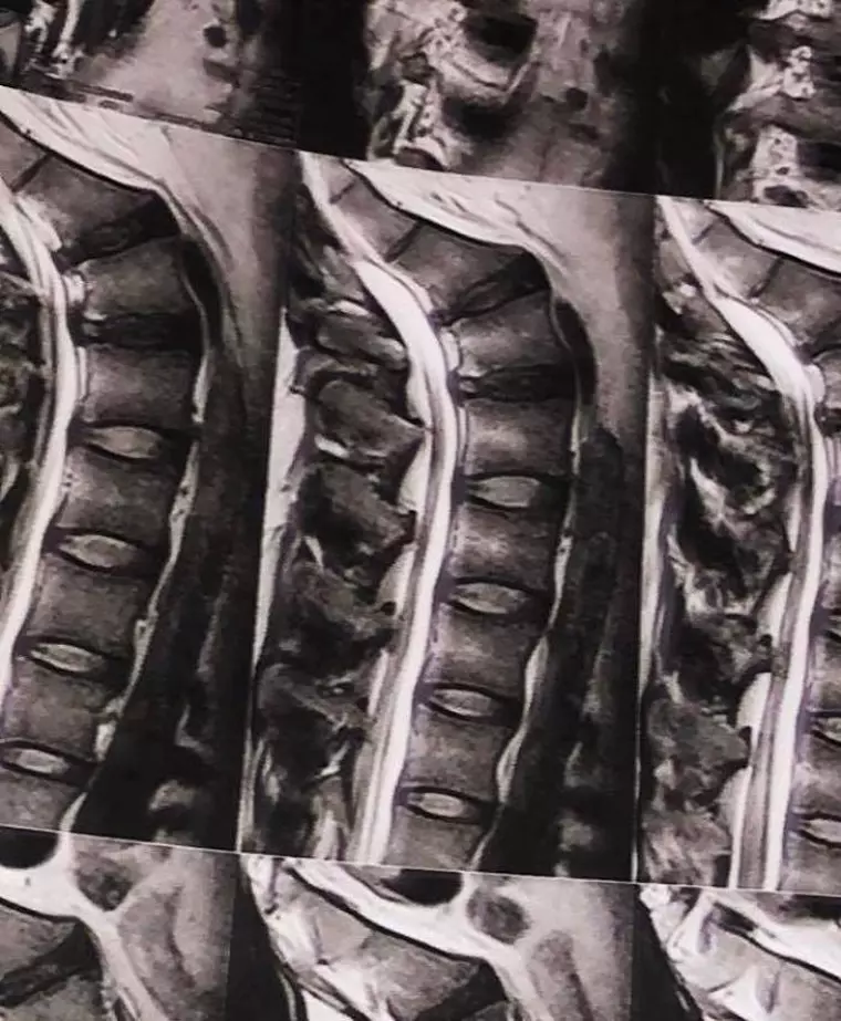 What’s Up are probleme de sănătate: ”Bine ai venit, 2020!”