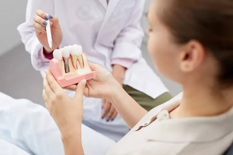 Avantajele și dezavantajele implantului dentar