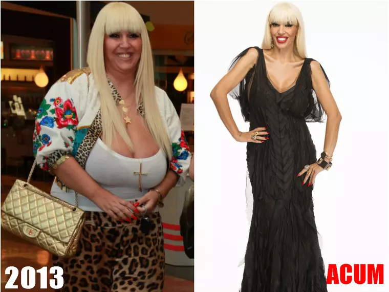 Raluca Bădulescu a slăbit 60 kg după operația de micșorare a stomacului