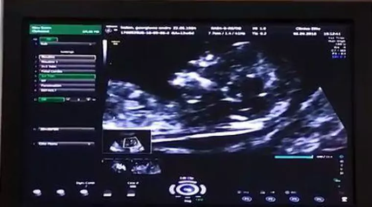 ce sex va avea copilul Andreei Bălan