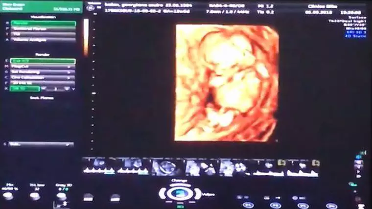 ce sex va avea copilul Andreei Bălan