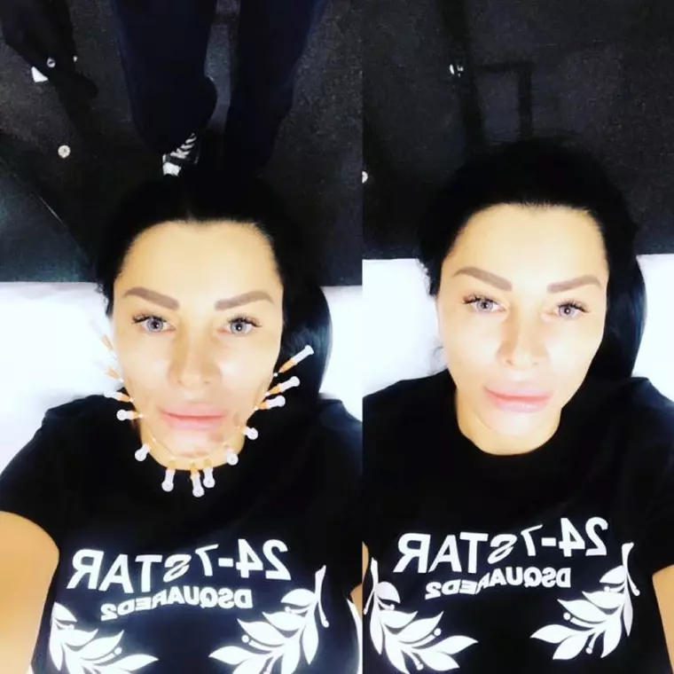 Brigitte Sfăt, intervenție estetică de 3.000 de euro