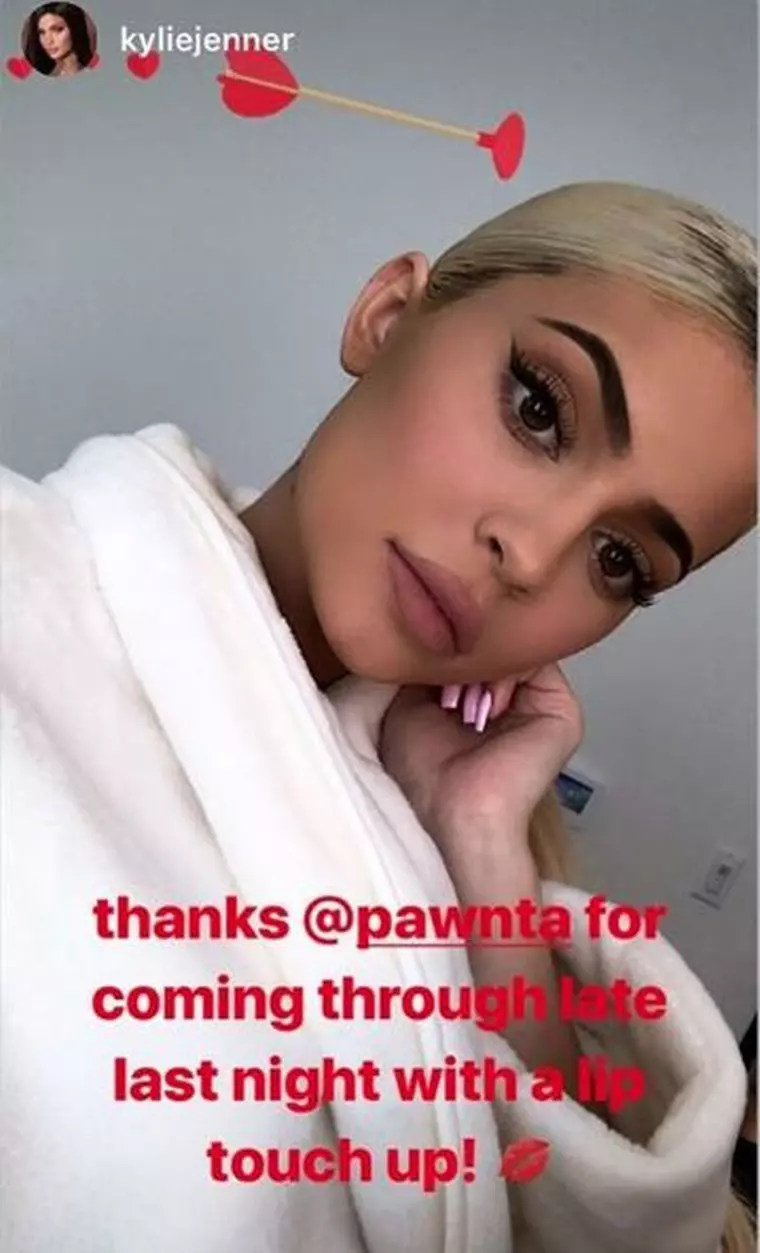 Kylie Jenner, după ce și-a injectat buzele