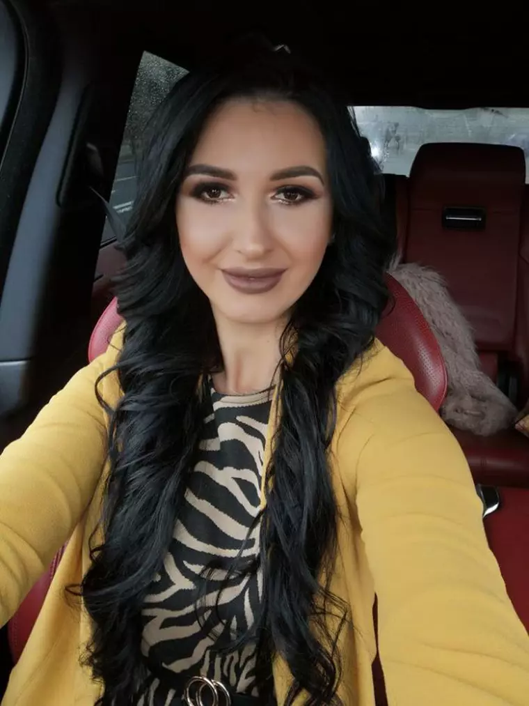 Mirela Banias, după cele 5 intervenţii estetice