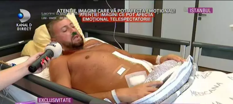 Cătălin Botezatu a fost operat în Turcia