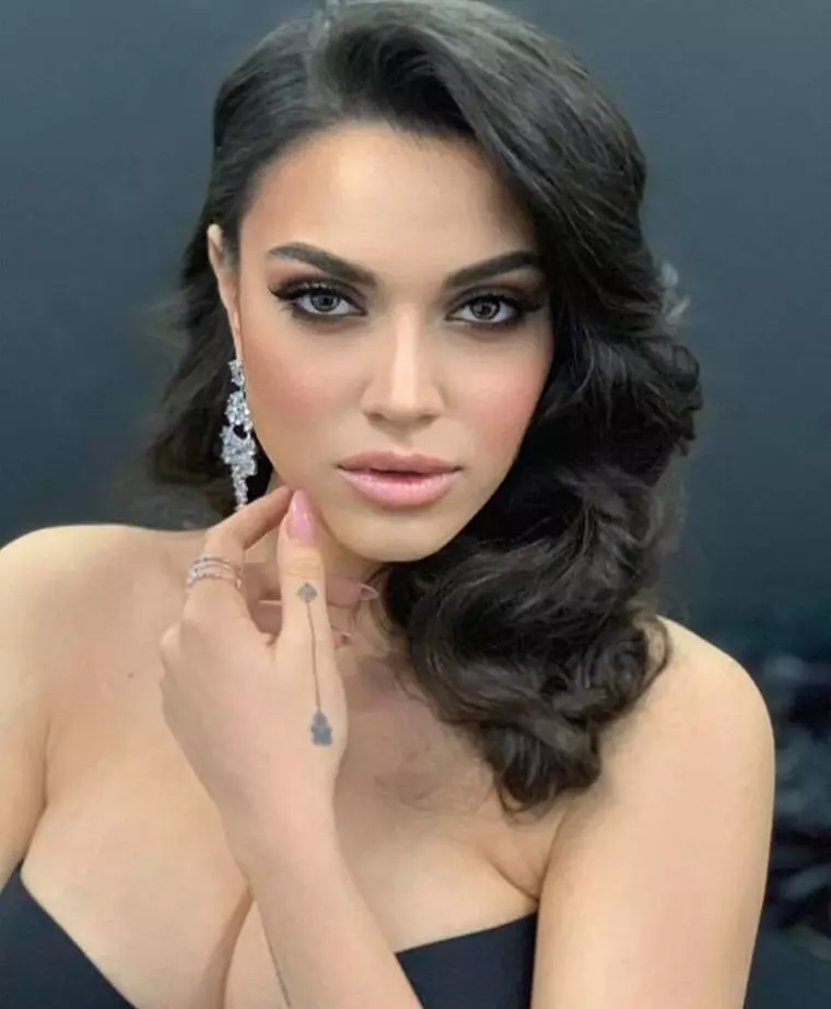 Karmen-prima-intervenție-estetică-11