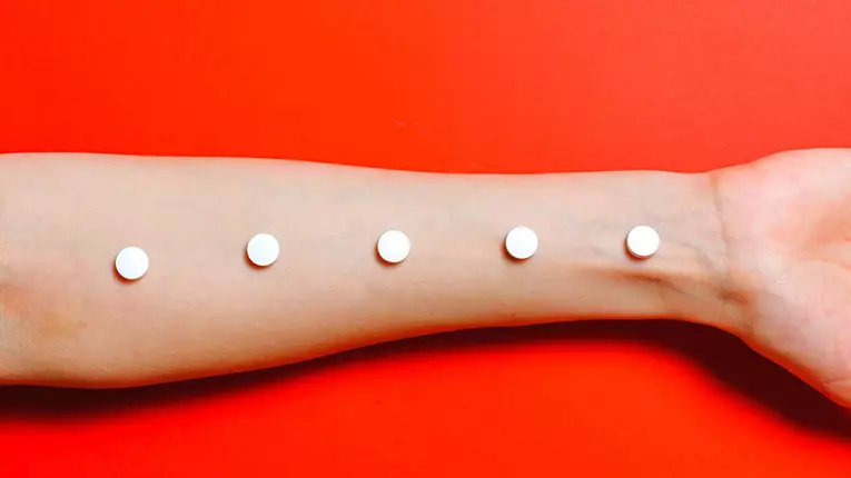 De ce apare urticaria și cum putem ameliora simptomele acesteia?