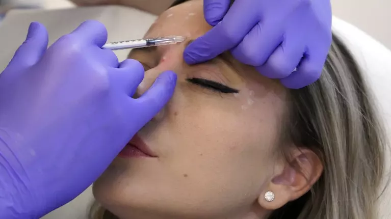 Ridurile de pe frunte după 40–45 de ani: Botox, laser CO2 sau masaj sculptural? Ce face fiecare, ce NU face și de ce este esențial când le faci
