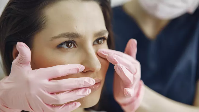 Rinoplastie fără operație: corectarea formei nasului cu tehnici minim invazive