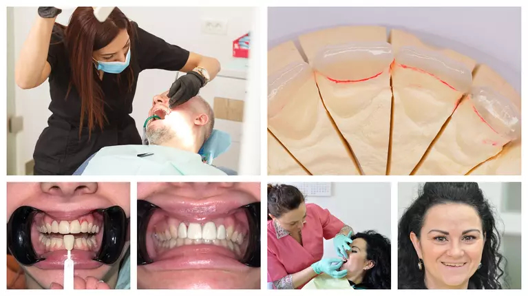 Atelierul de Zâmbete explică de ce păstrarea structurii naturale a dintelui contează în estetica dentară